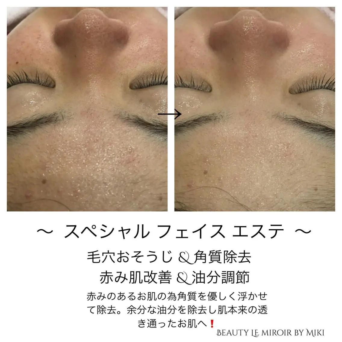 ビューティー ミロワールのエステ・リラクイメージ