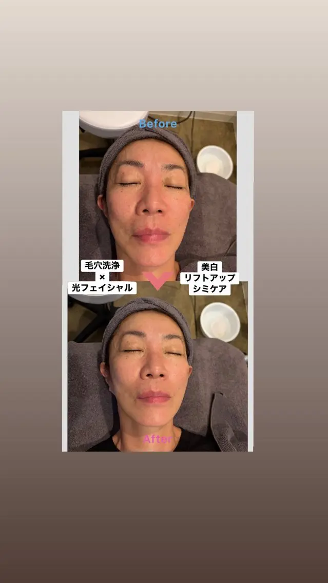 エステ 韓国肌管理 Mikiのエステ・リラクイメージ