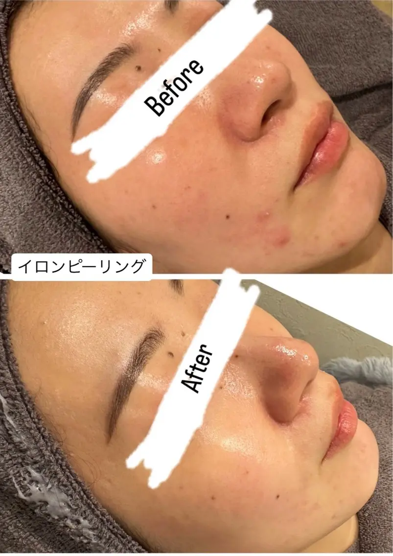 エステ 桐山 まどかのエステ・リラクイメージ