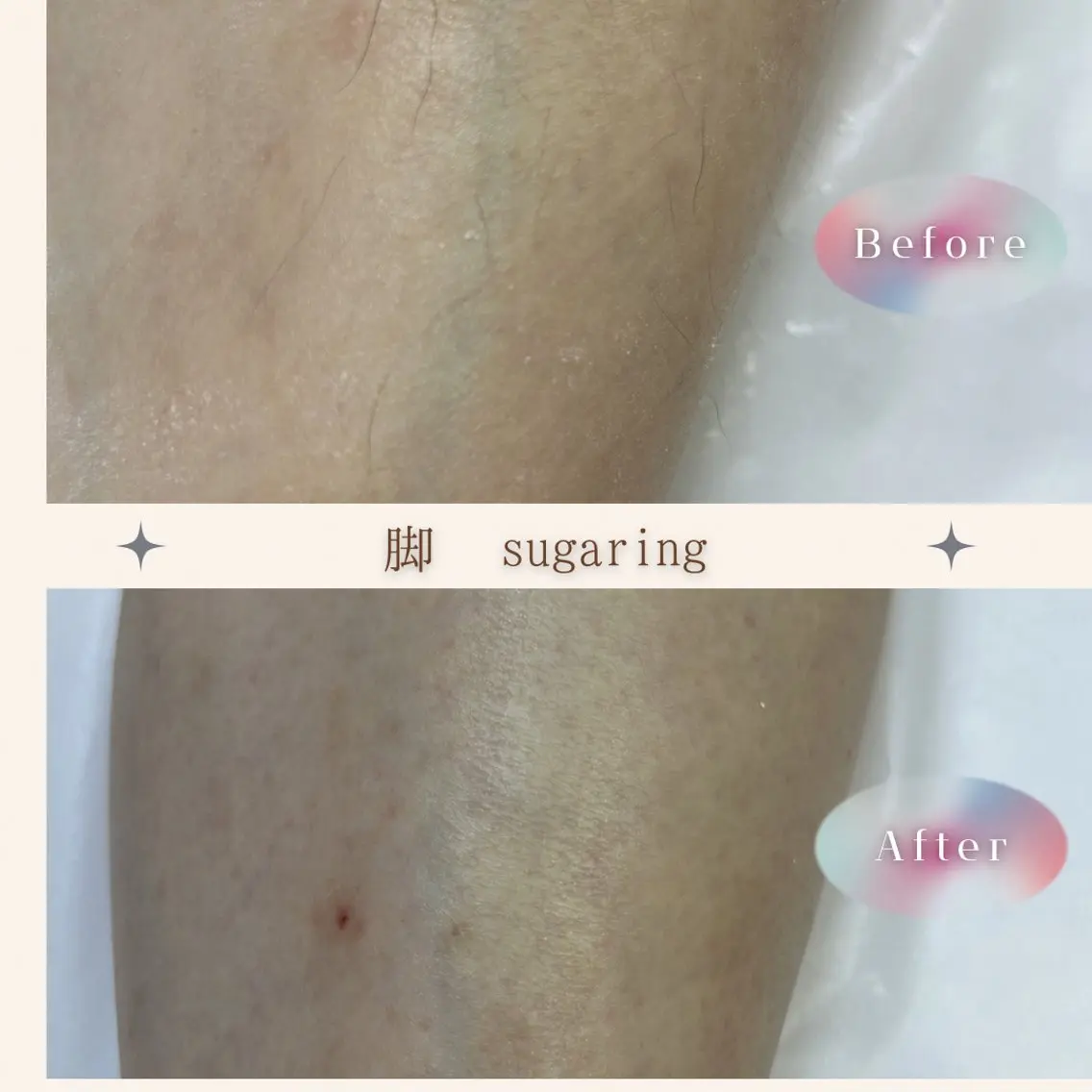 sugaring miiiのエステ・リラクイメージ