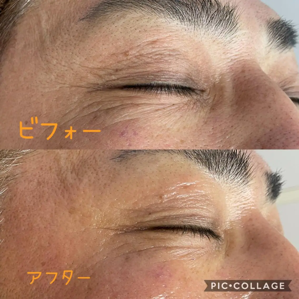 エステサロン LilyRoseのエステ・リラクイメージ