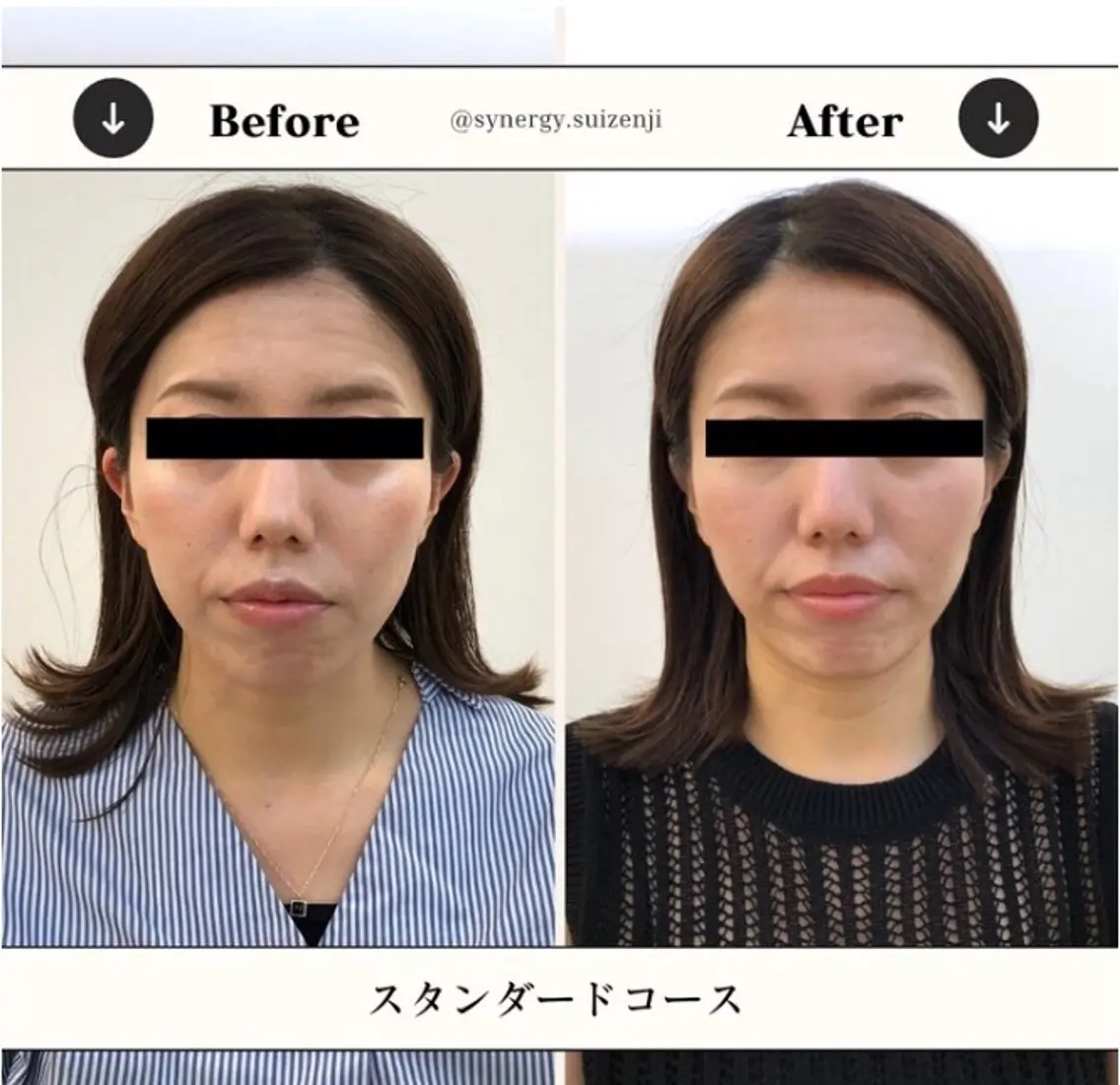 SYNERGY+ 熊本水前寺店のエステ・リラクイメージ