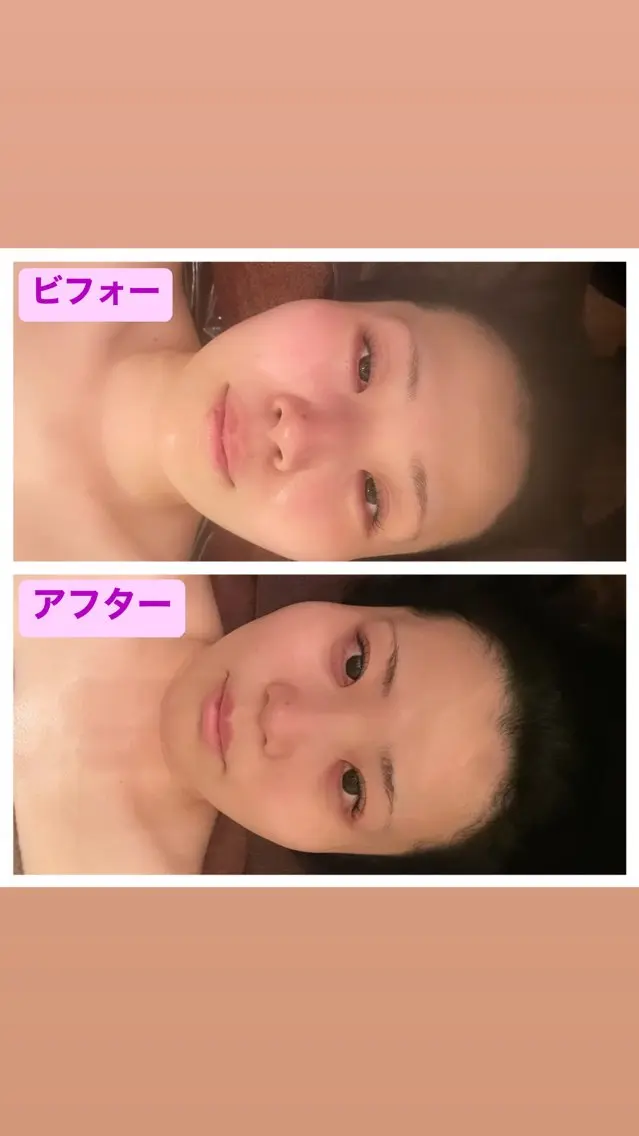 小顔&美肌 サロンLINKAのエステ・リラクイメージ