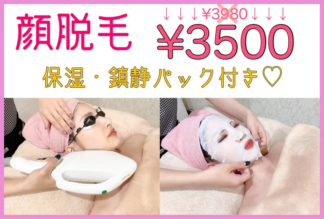 【お顔脱毛】高保湿パック付！うぶ毛レスでつるつるお肌♪化粧ノリUP　¥3500 何度でも◎の写真