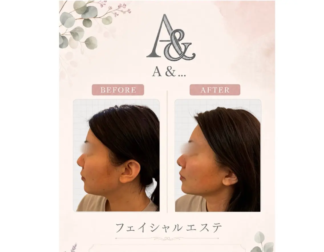 フェイシャル整顔エステ(特別3回セット)7月末まで!!!の写真