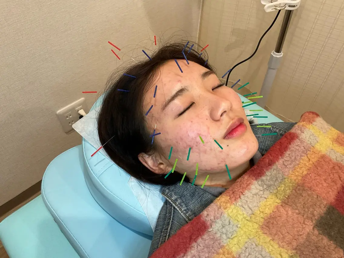エステ リラク けい整骨院 鍼灸院のその他イメージ