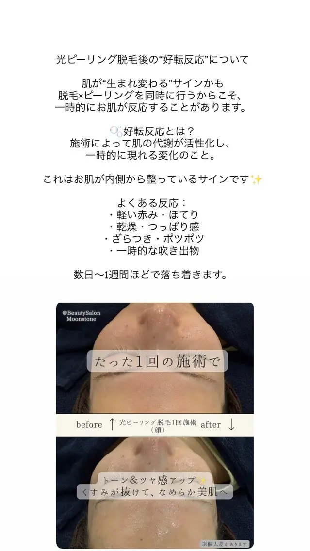 Moonstone 腸活ダイエット・脱毛のエステ・リラクイメージ