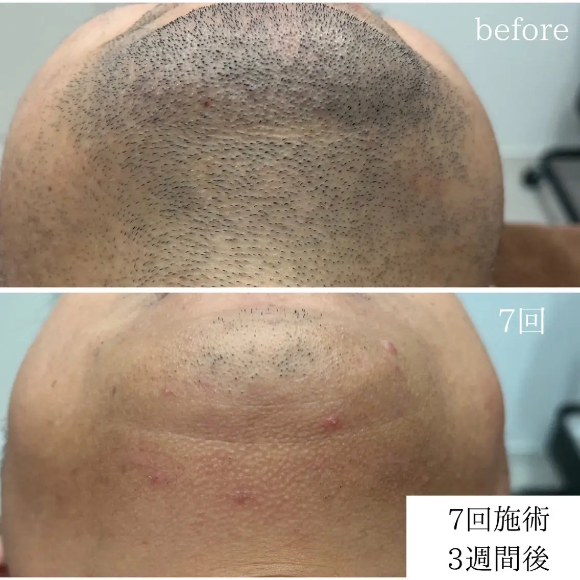 🌼SALON Lazuli久留米のエステ・リラクイメージ