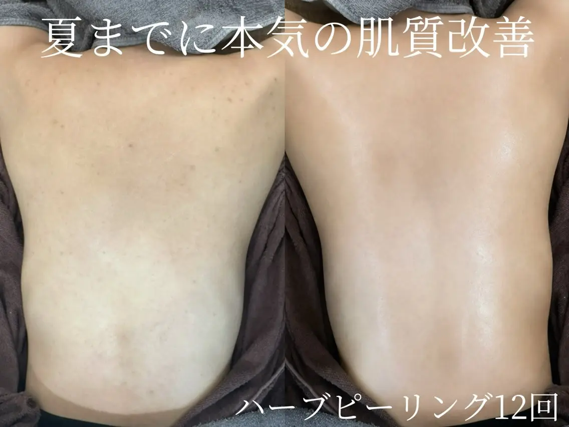 艶肌デトックス🫧 Samiraのエステ・リラクイメージ