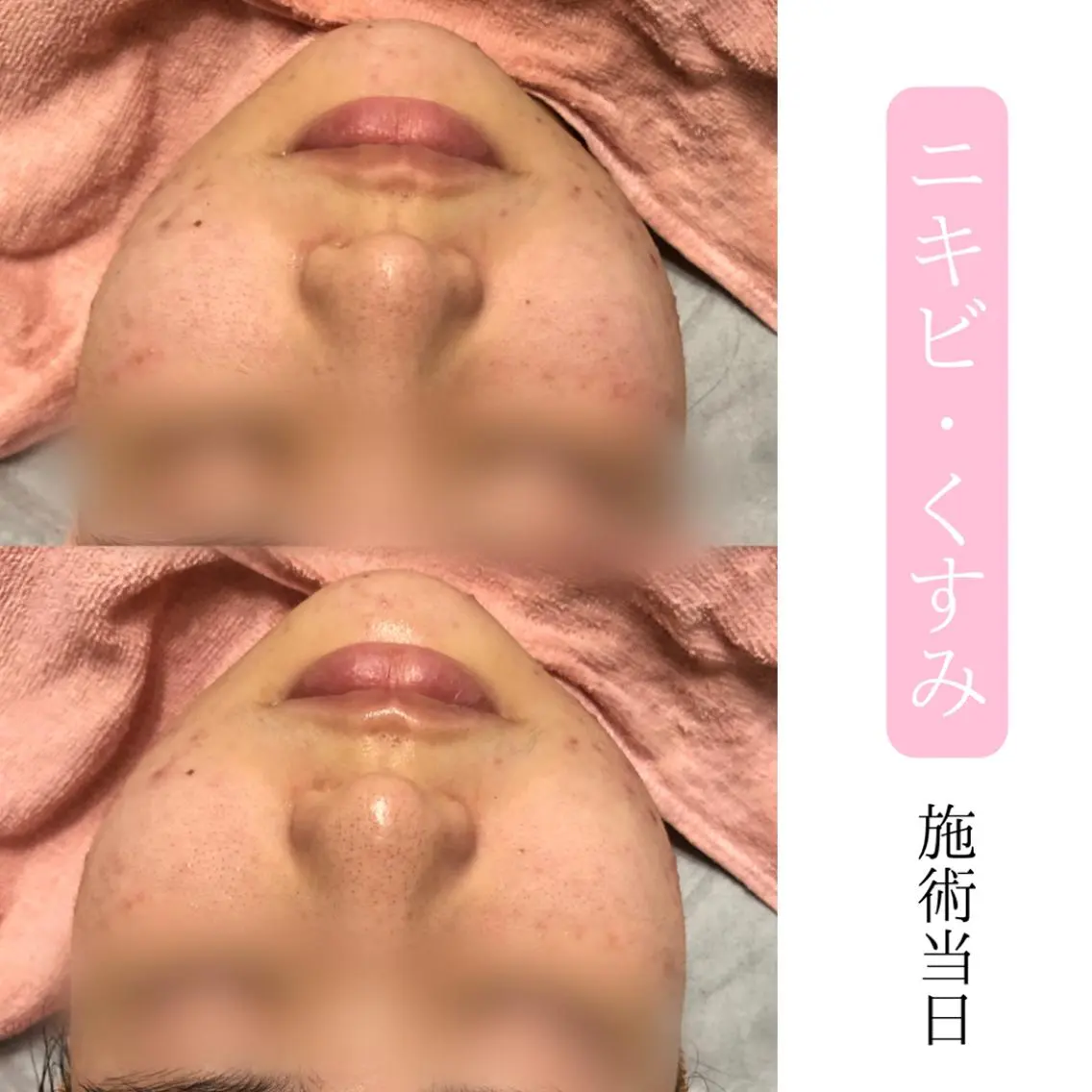 肌質改善サロン BestBelleのエステ・リラクイメージ