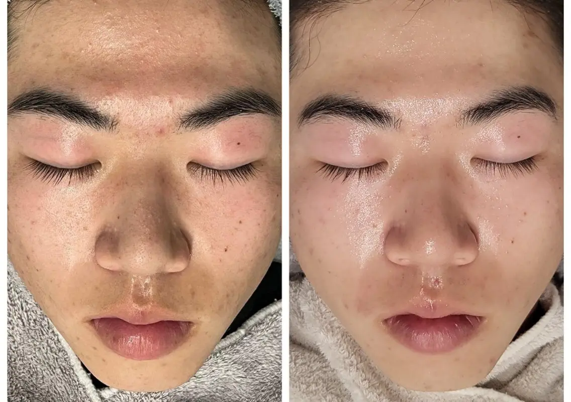 メンズ エステ Lino SALONのエステ・リラクイメージ