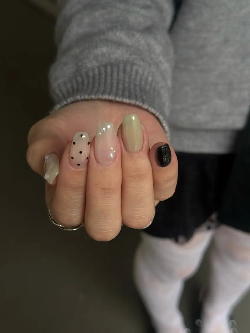 【 新規限定 】 skin design (オフケア込み)の写真
