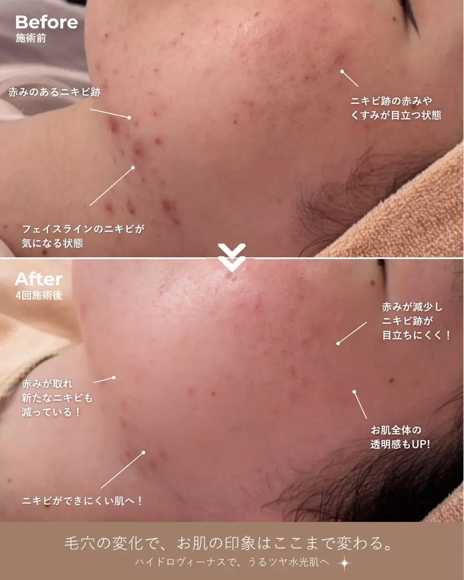 エステ 肌管理専門｜ Freviaのエステ・リラクイメージ