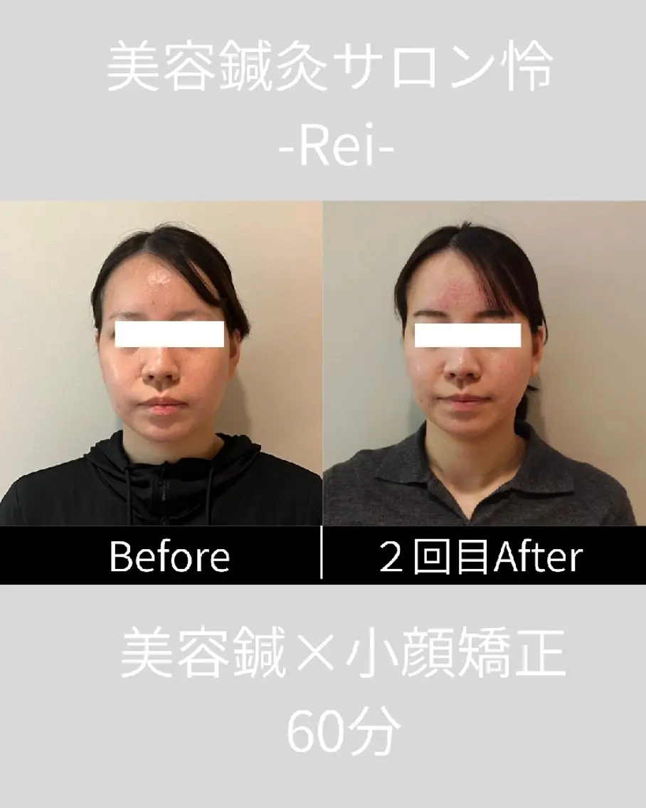 美容鍼灸サロン怜 -Rei-のエステ・リラクイメージ