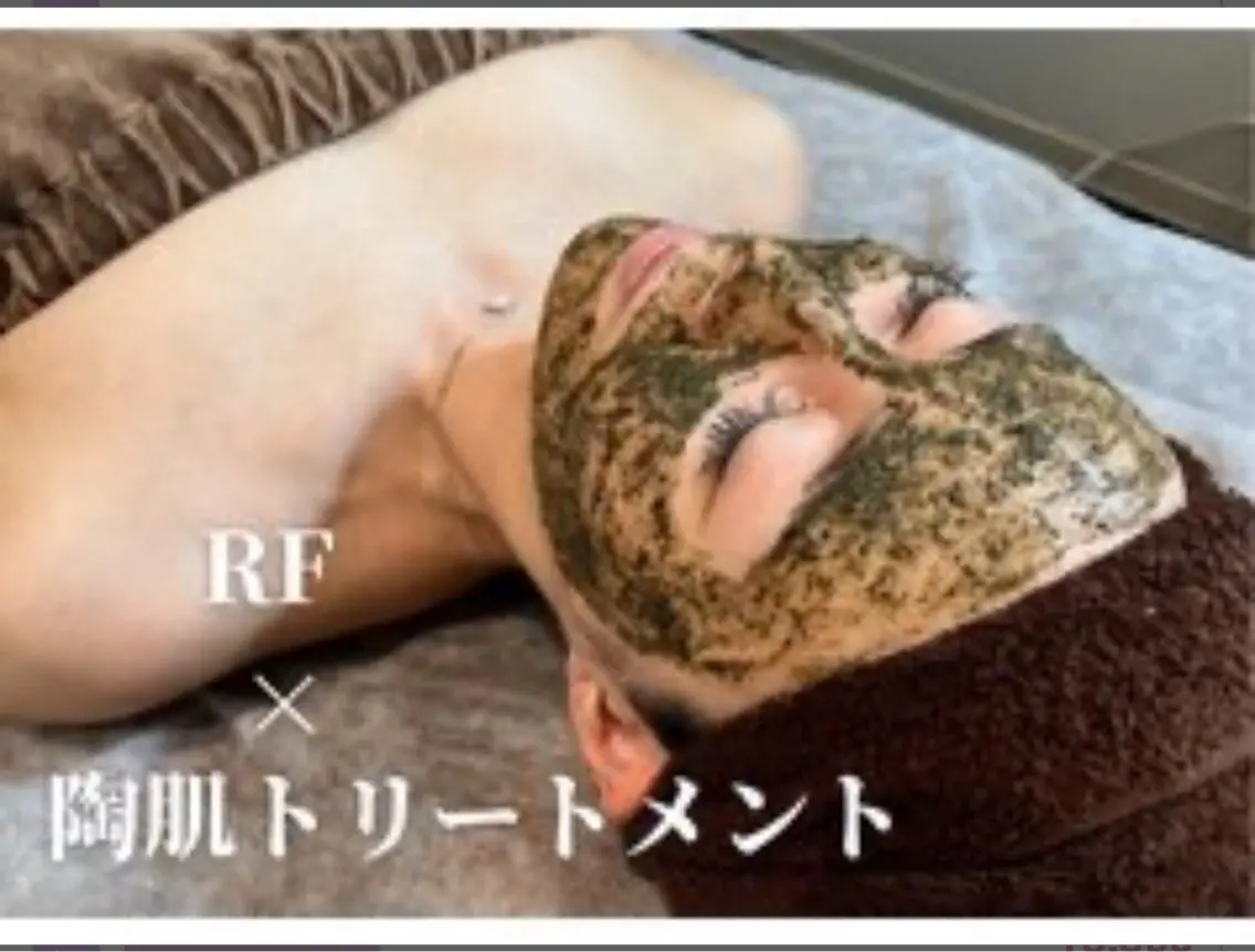 REVIハーブピーリング🌿練習モデルの写真