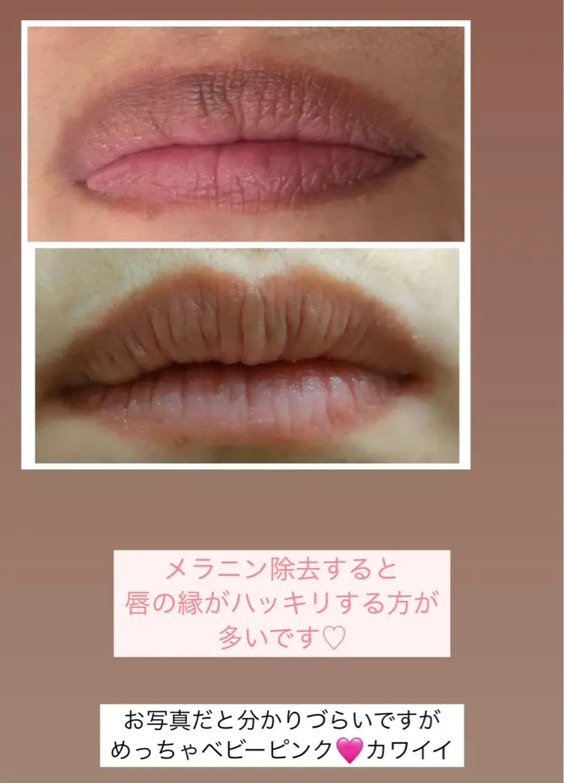 Raviy 【痩身専門・肌管理】のエステ・リラクイメージ