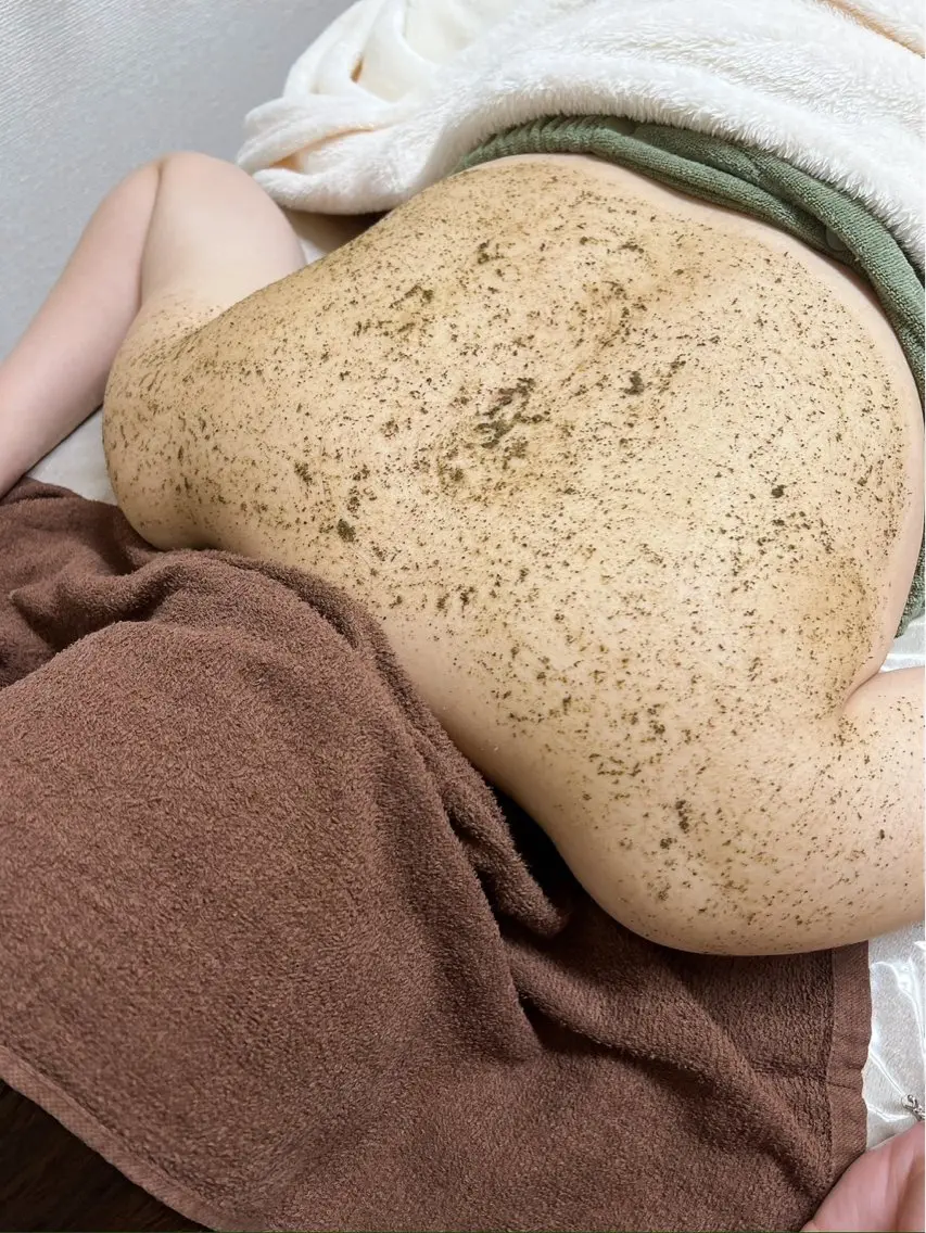 《背中上部》ハーブピーリング【ニキビ.黒ずみ.毛穴】🌿,,の写真