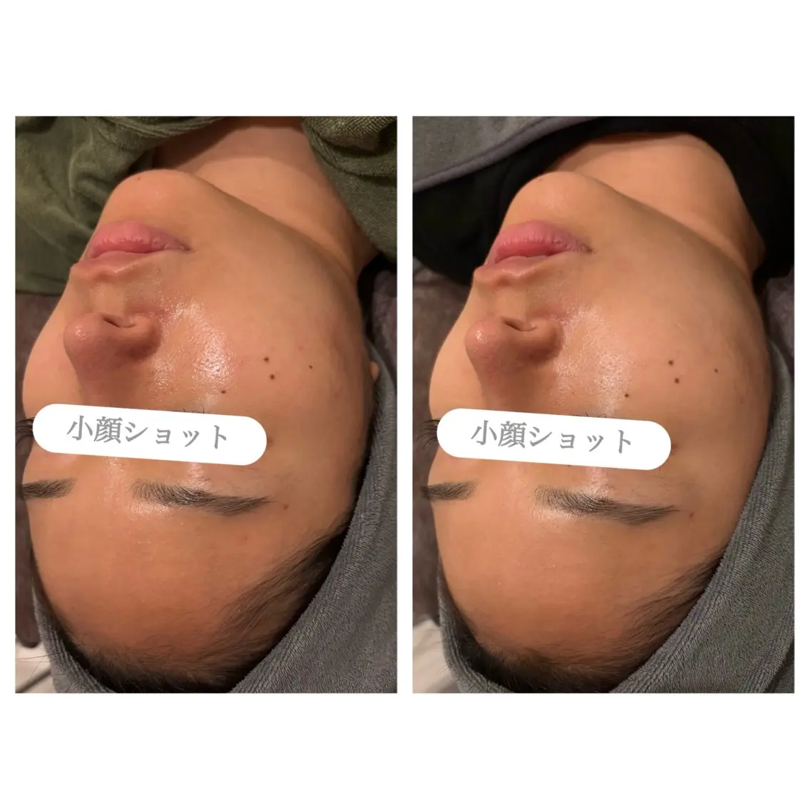エステ 表参道エステ痩身 hiromiのエステ・リラクイメージ