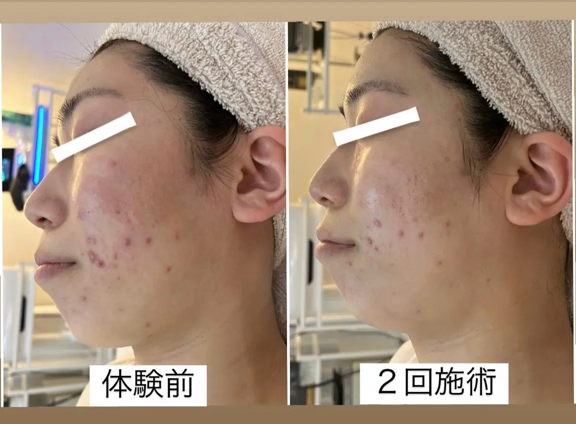 エステ 肌管理 OGUMOのエステ・リラクイメージ