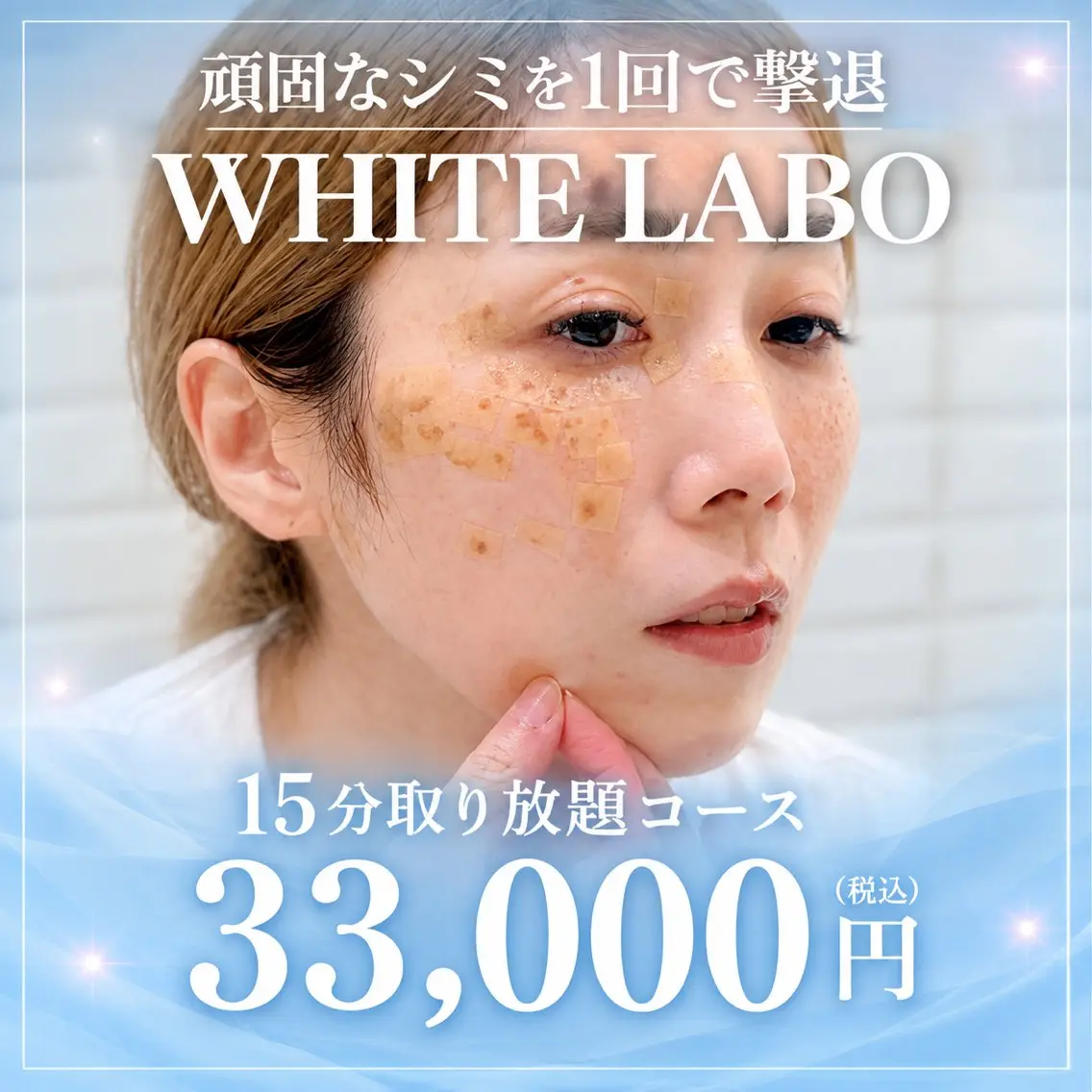 最新シミケア★ホワイトラボ【顔シミケア】の写真