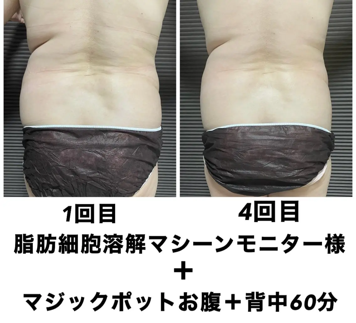 ネイル・エステサロン UILANIのエステ・リラクイメージ