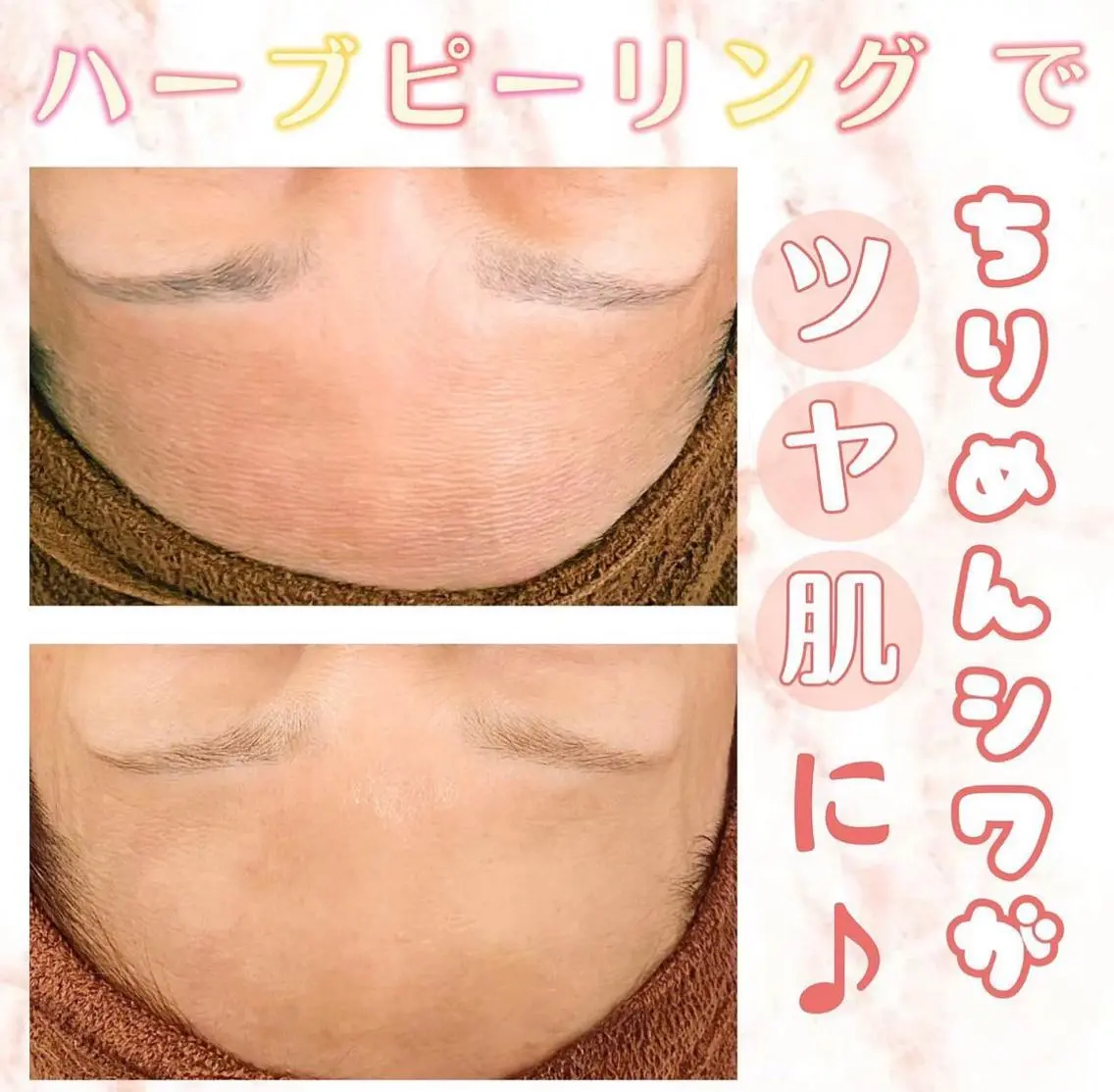エステ トラブル肌改善🏥 Meow！🫧🫧のエステ・リラクイメージ