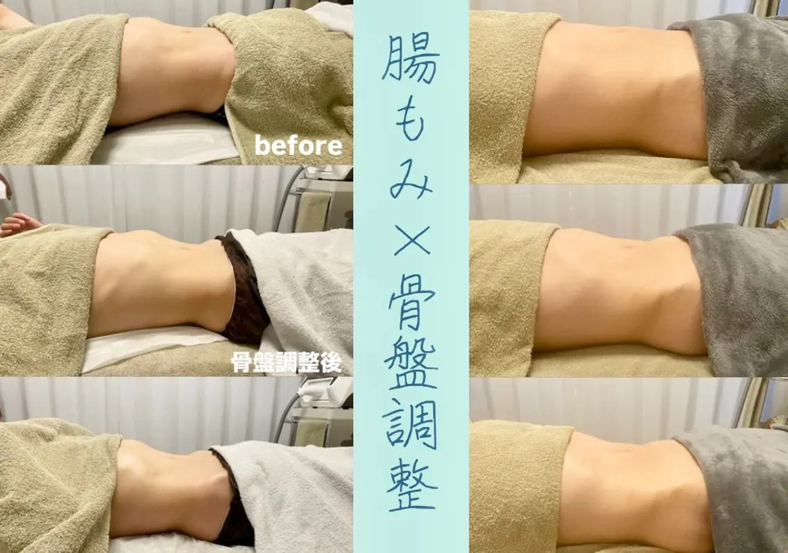 その他 腸もみ・メンズ脱毛・ 毛穴洗浄〜カナロア〜のエステ・リラクイメージ