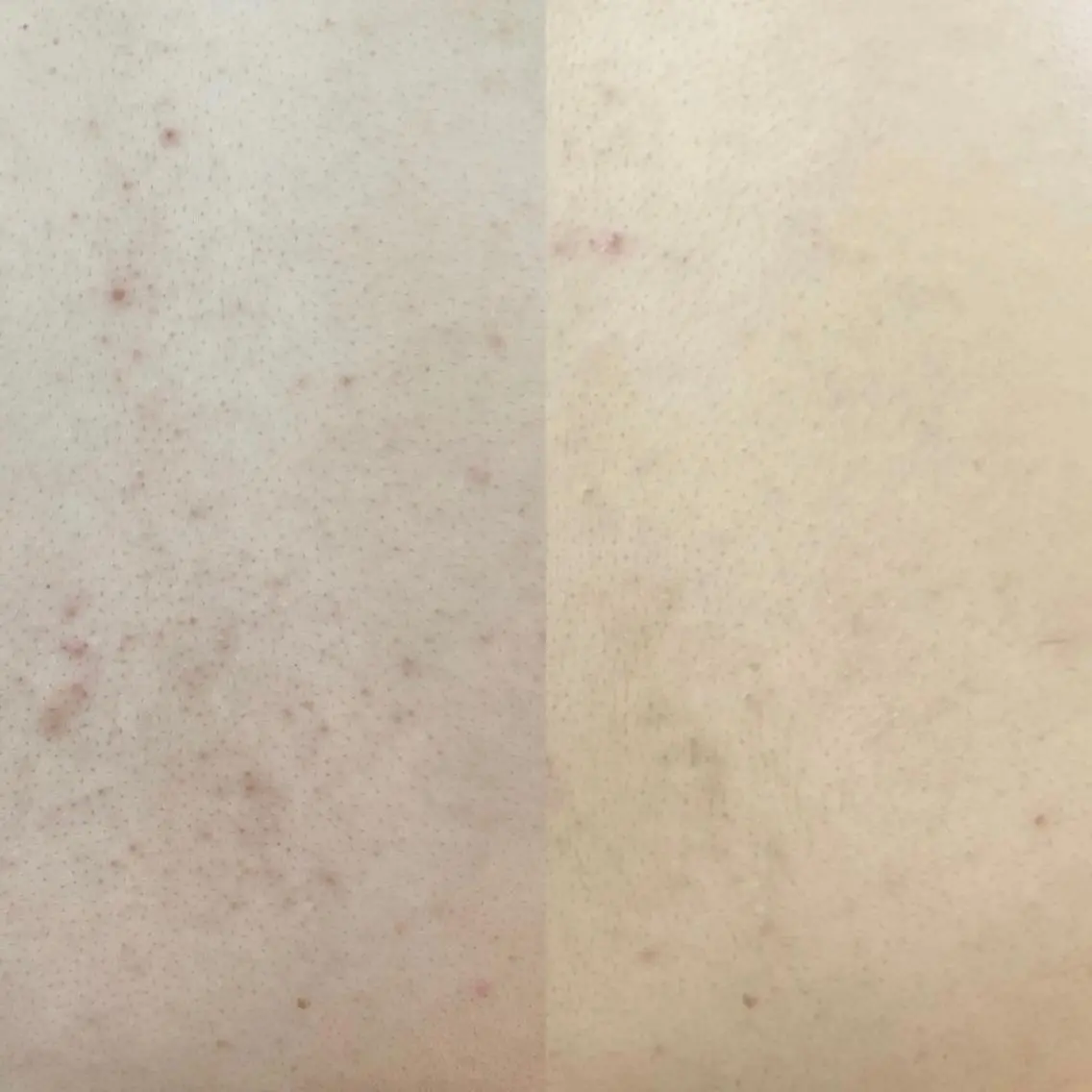 BeautySalo nCielChibaのエステ・リラクイメージ