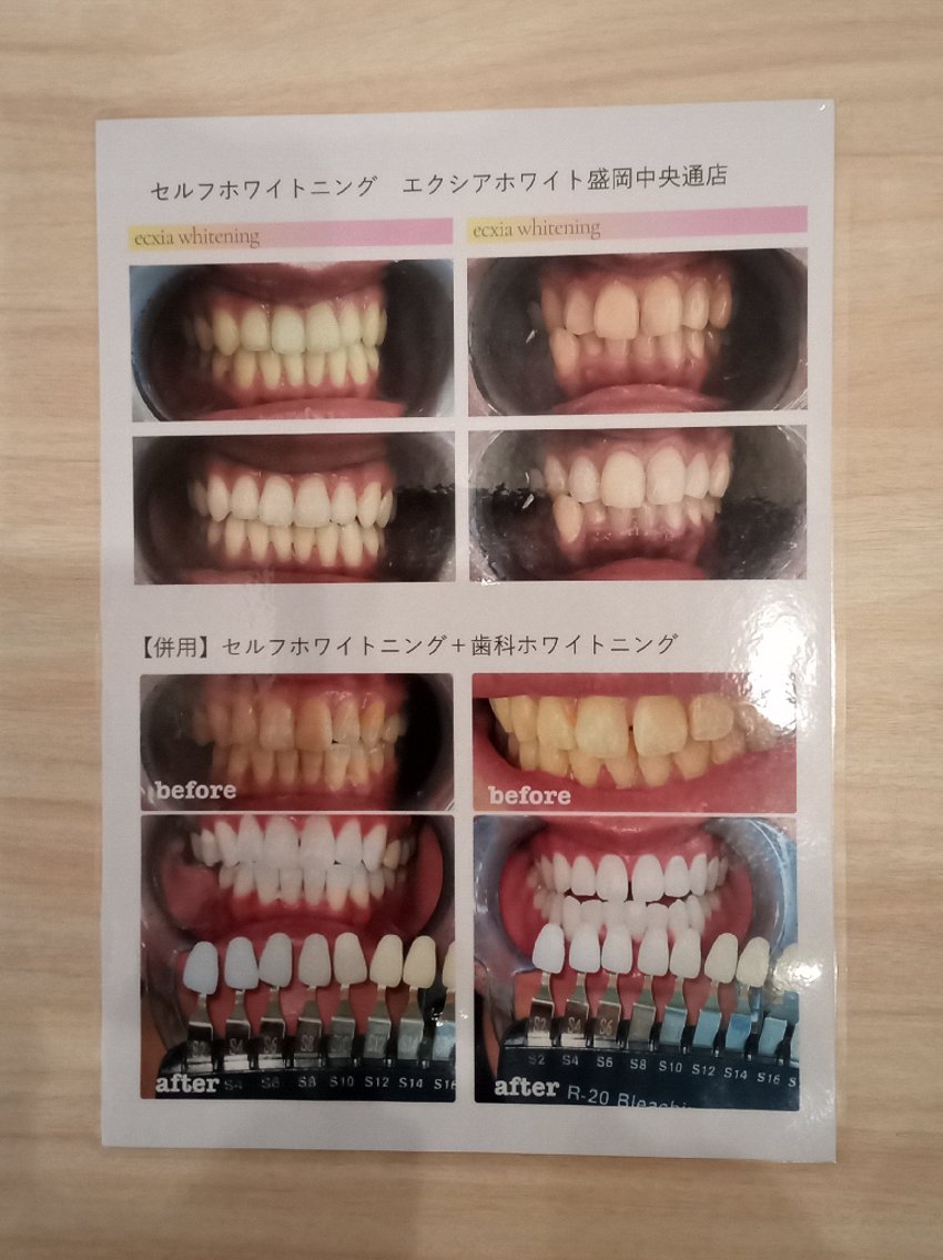 いぶ エクシア盛岡中央通店のエステ・リラクイメージ