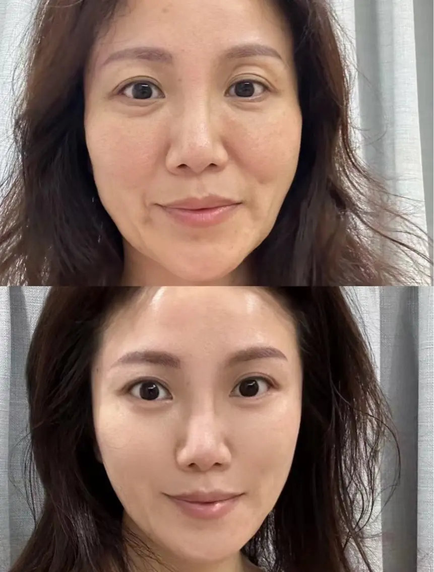 ネイル 愛維美水光専門店 川崎彩鳳のエステ・リラクイメージ