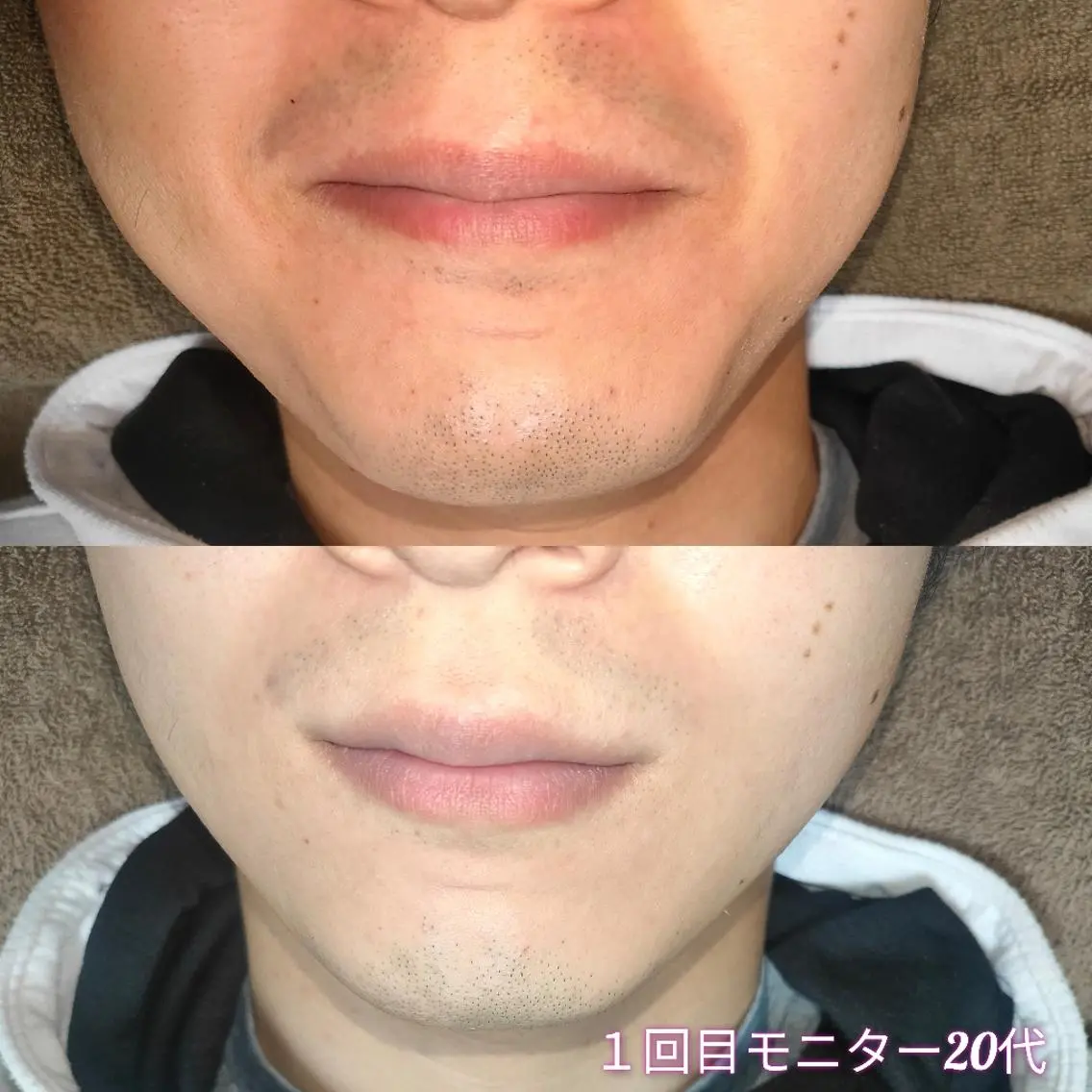 メンズ 脱毛 武 藤のエステ・リラクイメージ