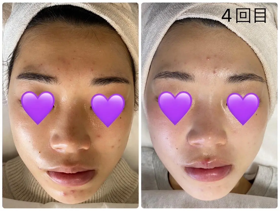 エステ COCO beautyサロンのエステ・リラクイメージ