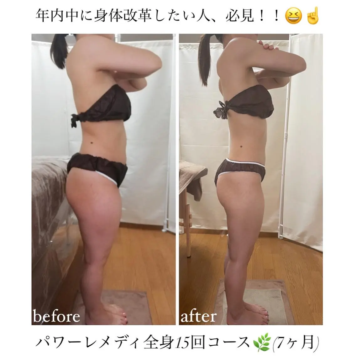《本気痩せ×疲労改善 》 BILOOPのエステ・リラクイメージ