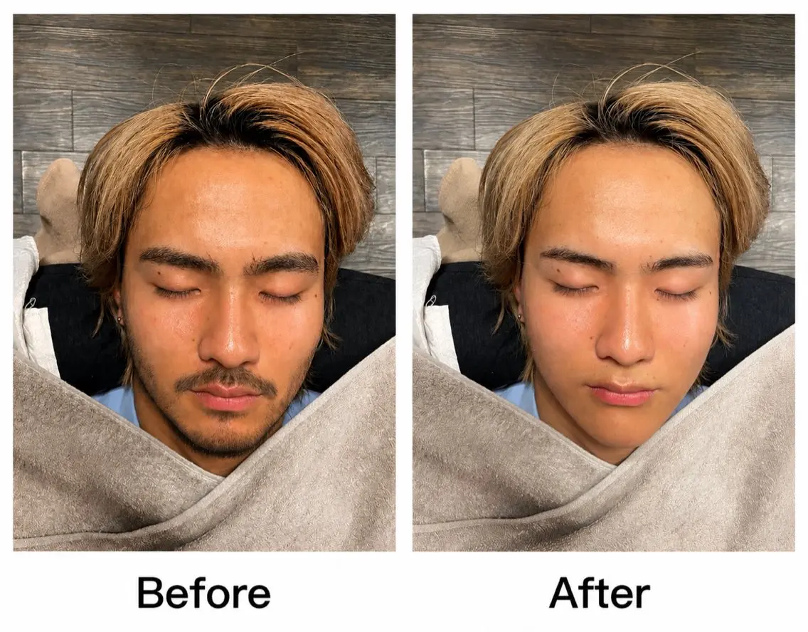 【髭の濃い方限定】メンズシェービング💈✨の写真