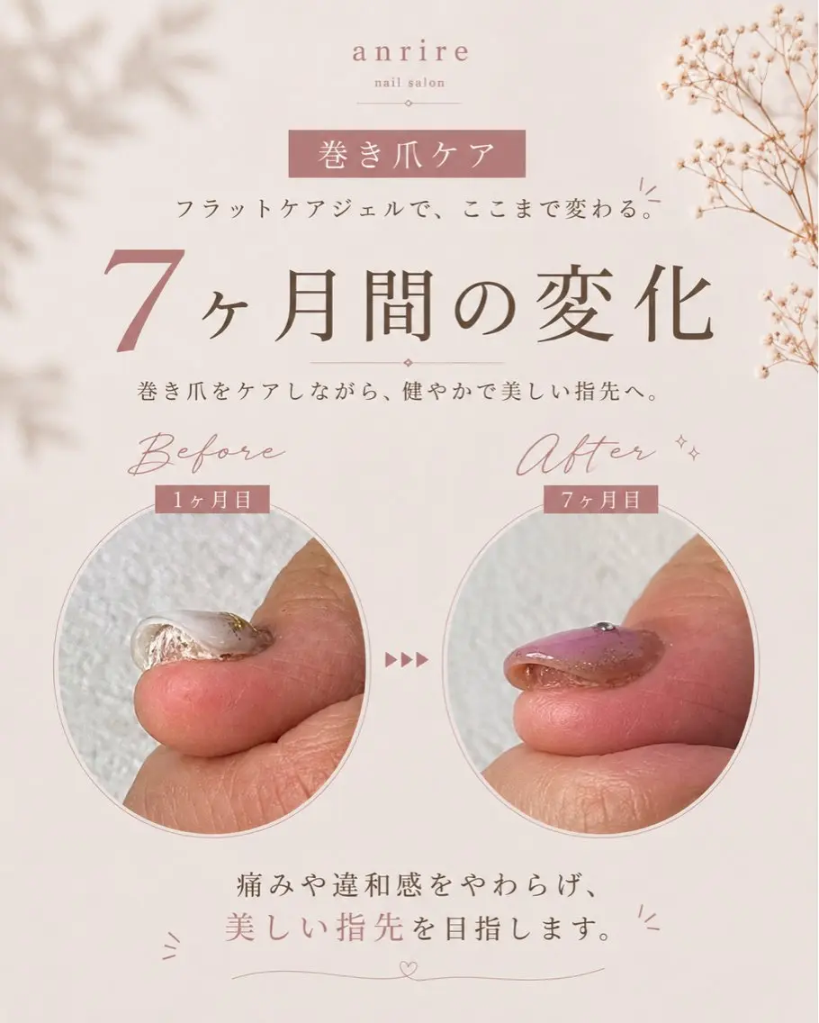 ネイル フットネイル ジェルネイル nailsalon anrireのネイルデザイン