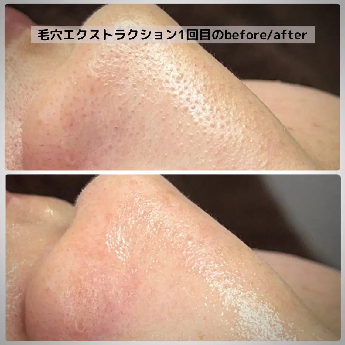 エステ Muqu. 毛穴サロンのエステ・リラクイメージ