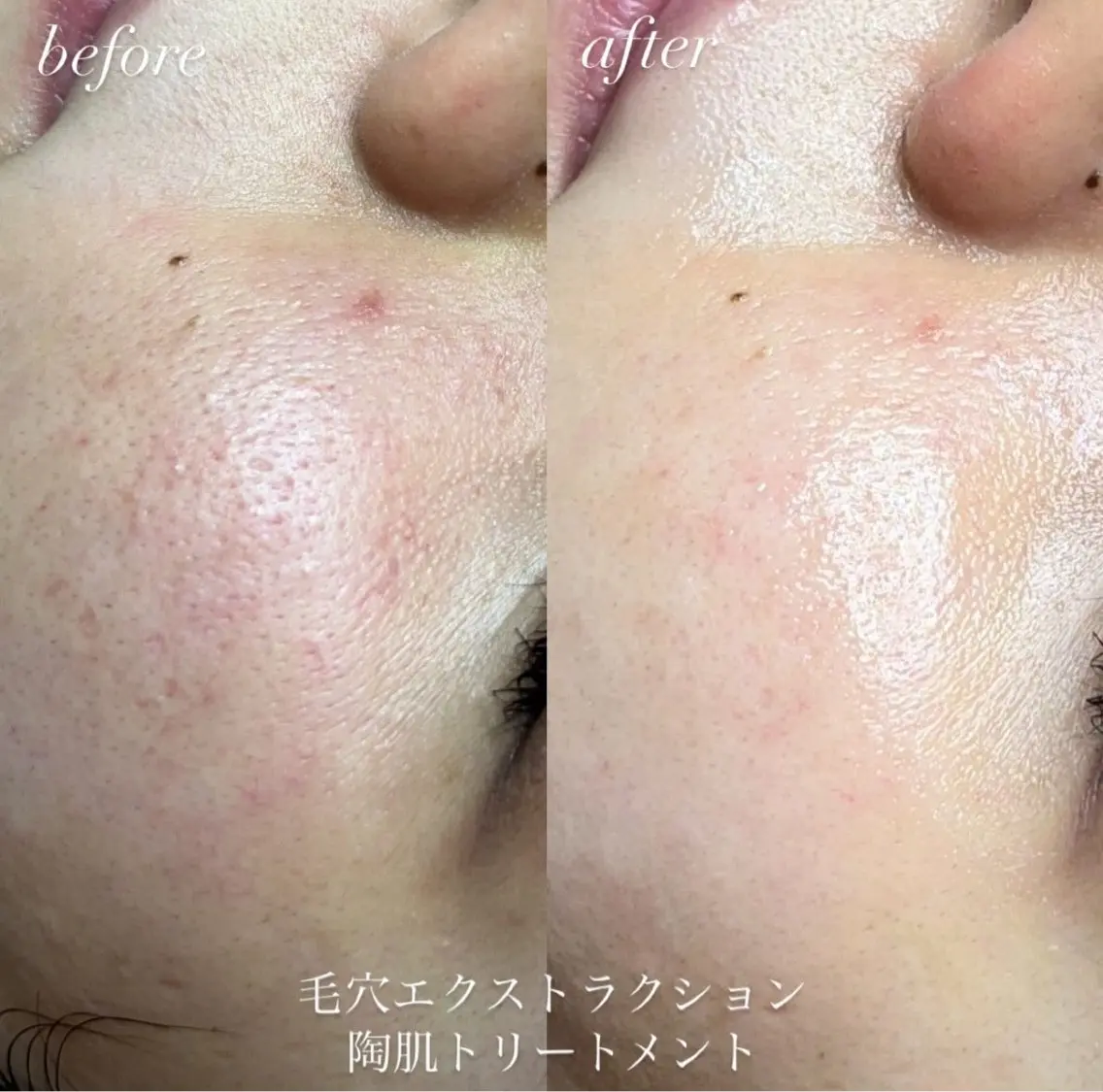 エステ リラク beauty salonWのエステ・リラクイメージ