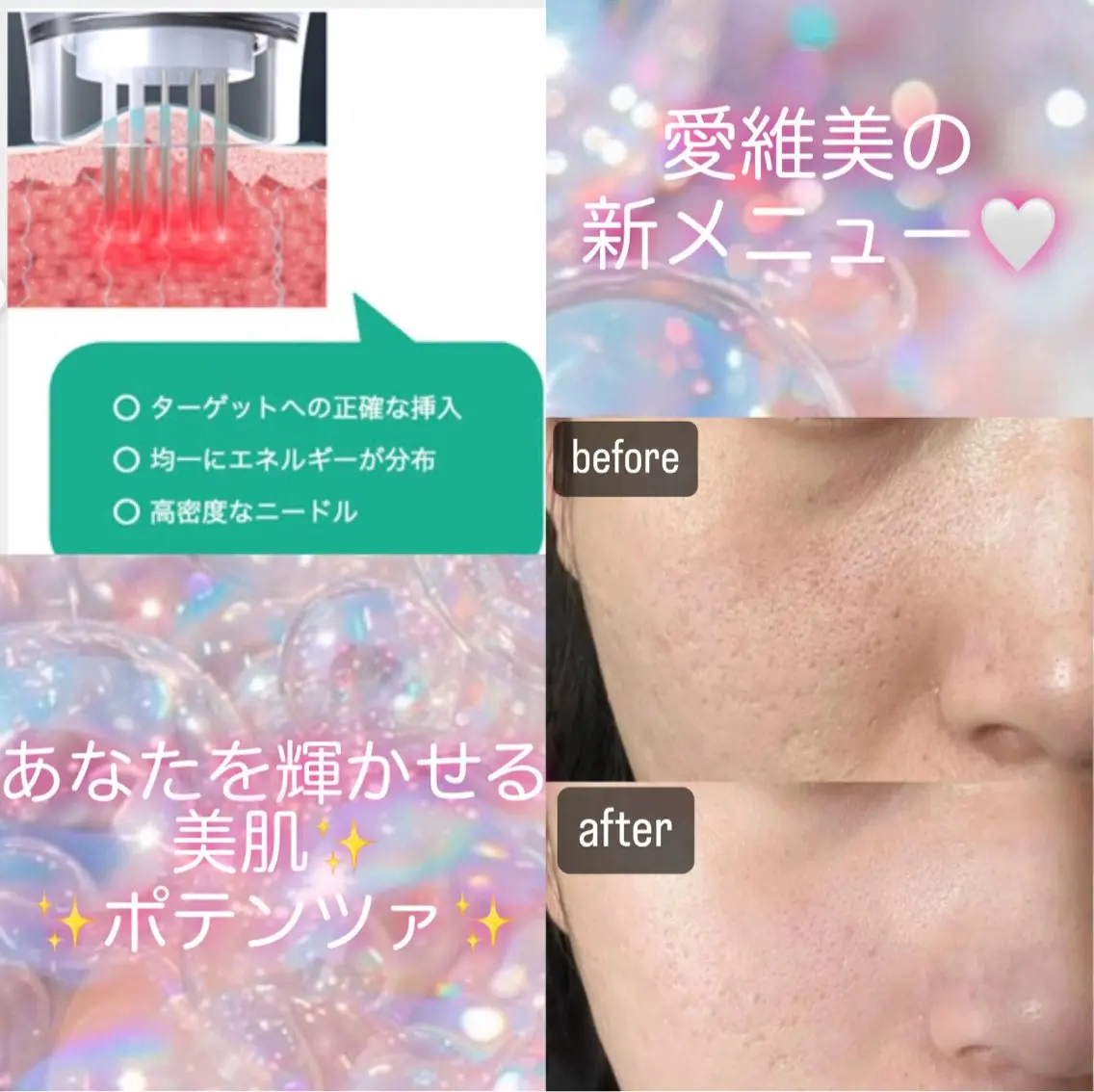 マツエク・マツパ エステ 愛維美水光美肌専門店 メンズレディースokのエステ・リラクイメージ