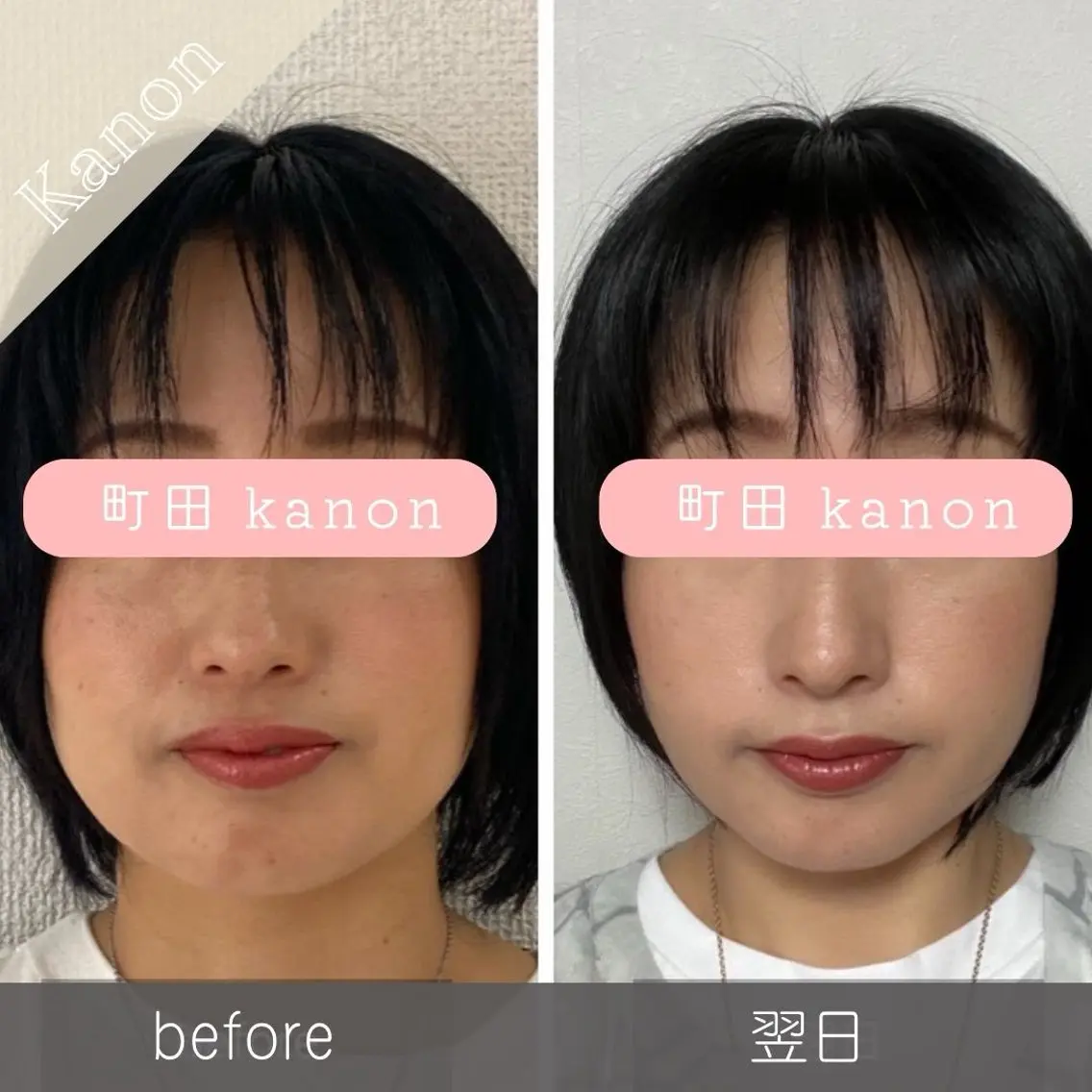小顔矯正サロン町田 逸見智美のエステ・リラクイメージ