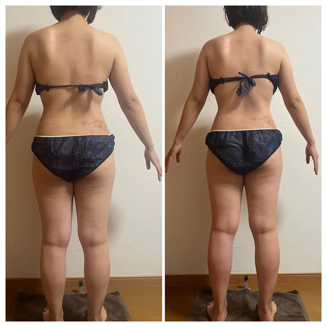 【新規】【上半身痩せ】背中・お腹・二の腕スッキリ✨見た目変化重視の写真