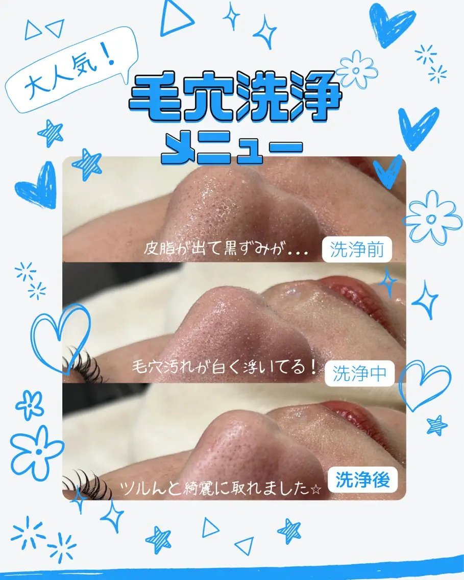 その他 🩵新宿シェービング 店長🩵清水のその他イメージ