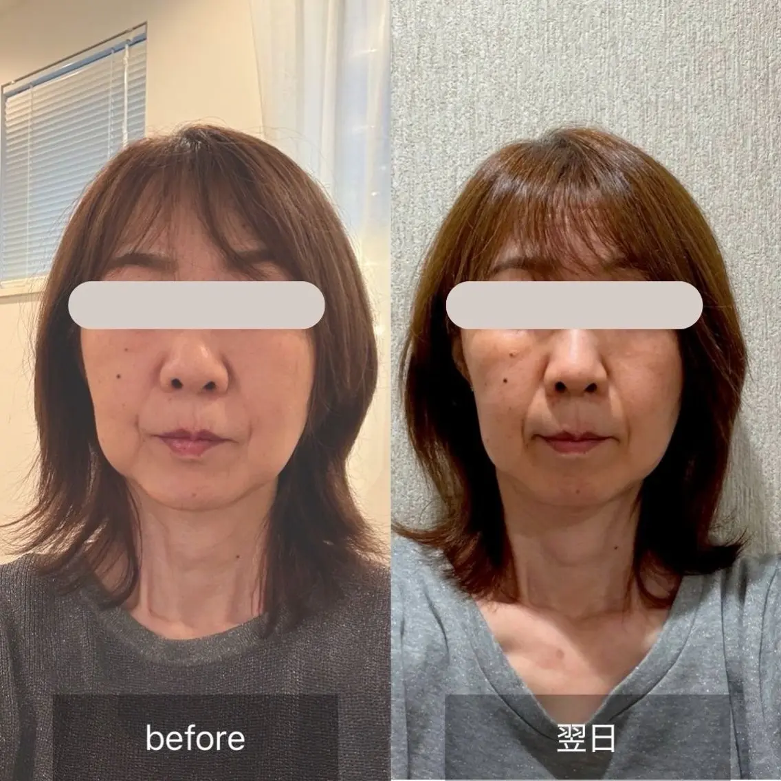 小顔矯正サロン町田 逸見智美のエステ・リラクイメージ