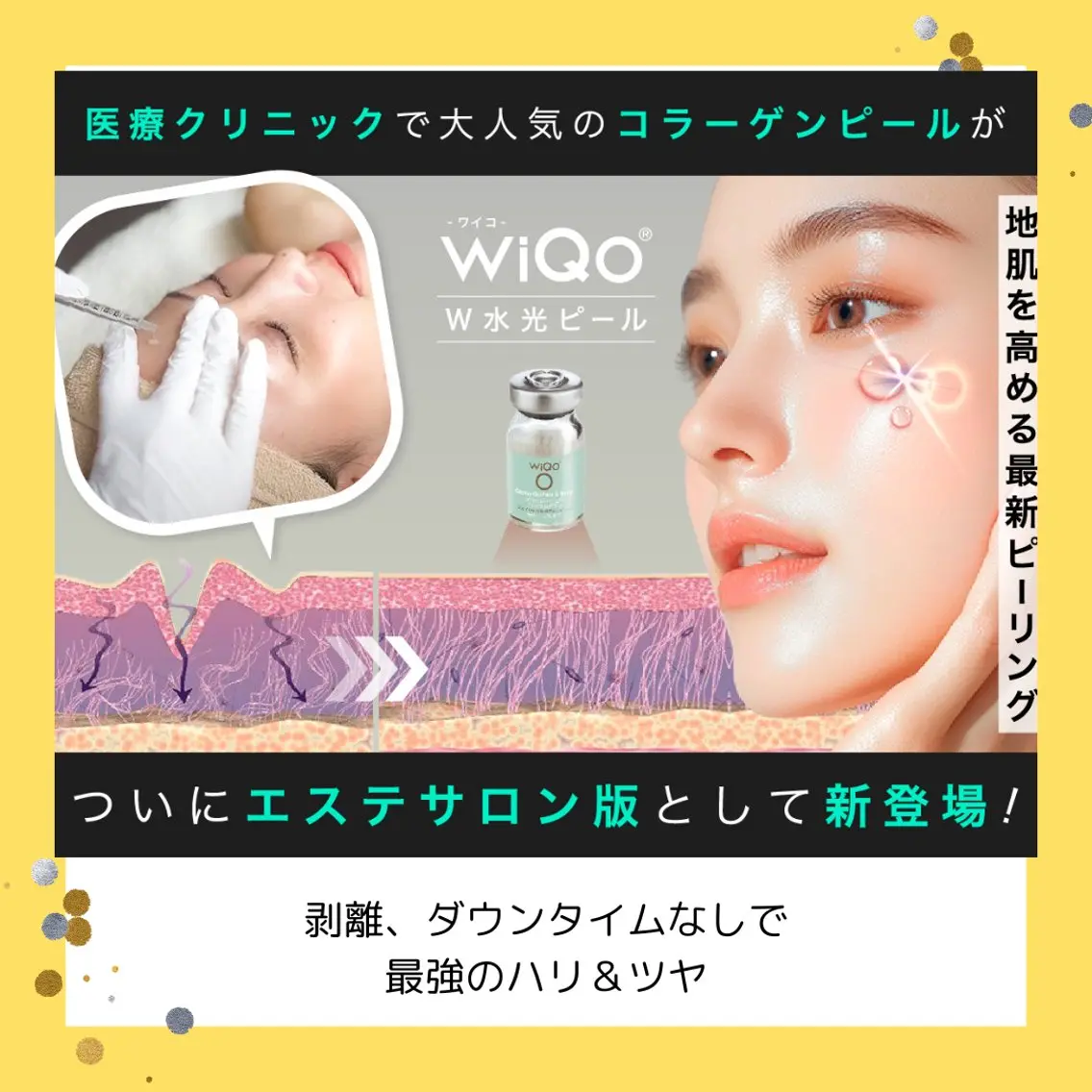 コラーゲンピールエステ版、WiQo水光ピーリングと小顔矯正でシュッとしたフェイスラインと、ツヤ＆ハリ肌へ✨の写真