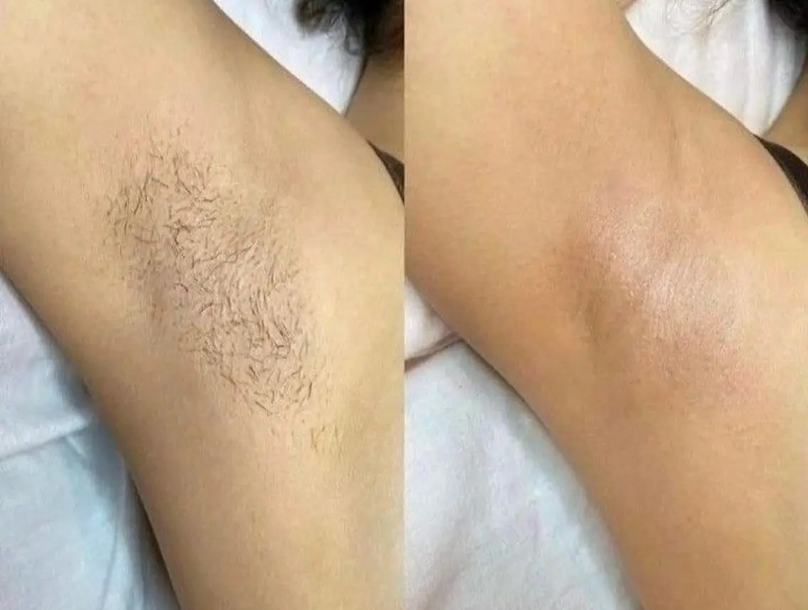 脱毛 プレパレサロン中目黒 WAX&Nailのエステ・リラクイメージ