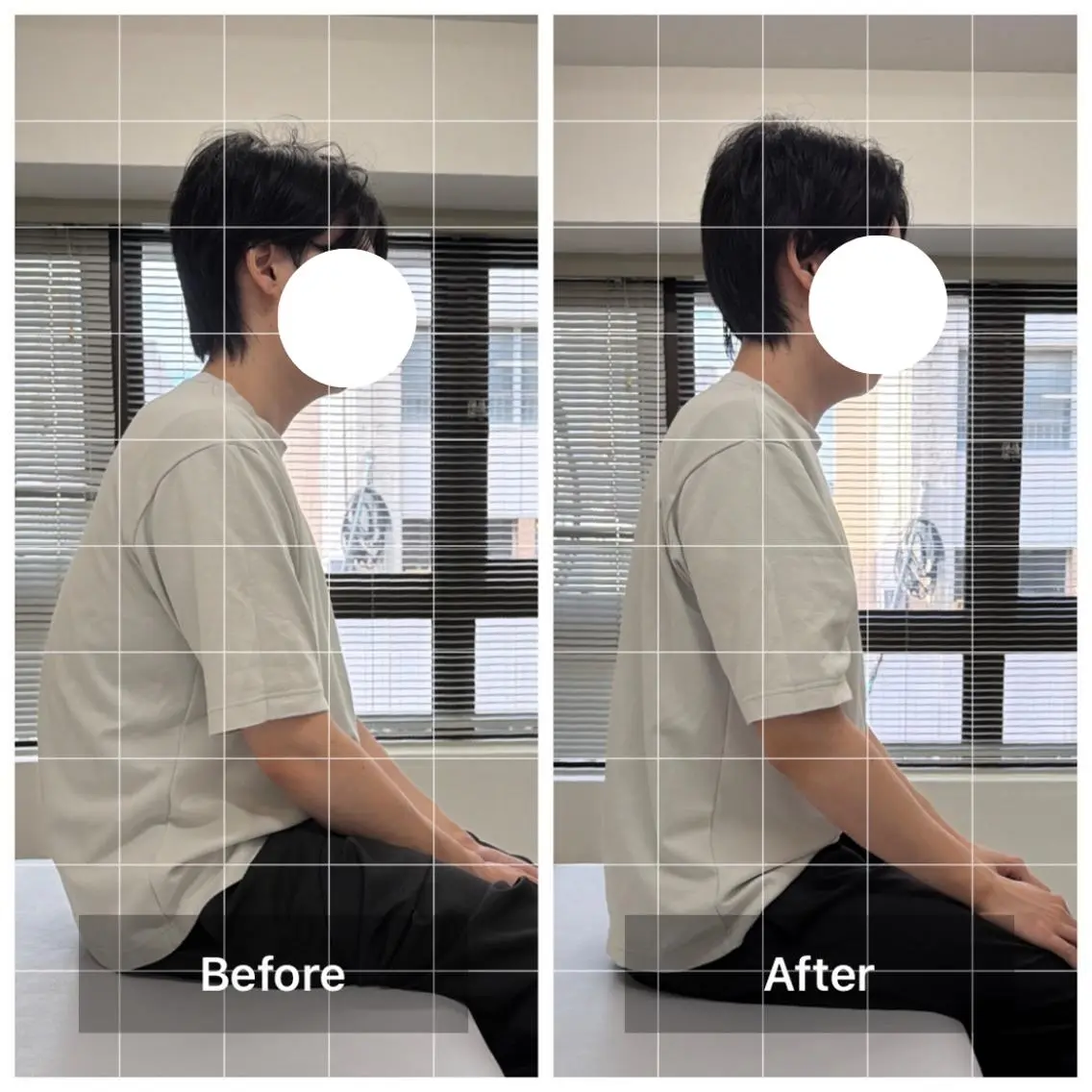 【ストレートネック改善】首・肩こり&猫背を徹底ケア★姿勢改善整体 6600円の写真