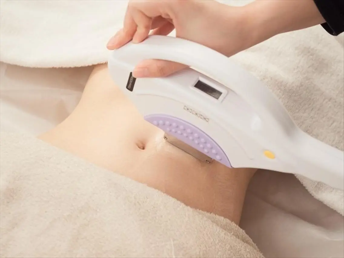 【女性限定】胸腹セット脱毛の写真