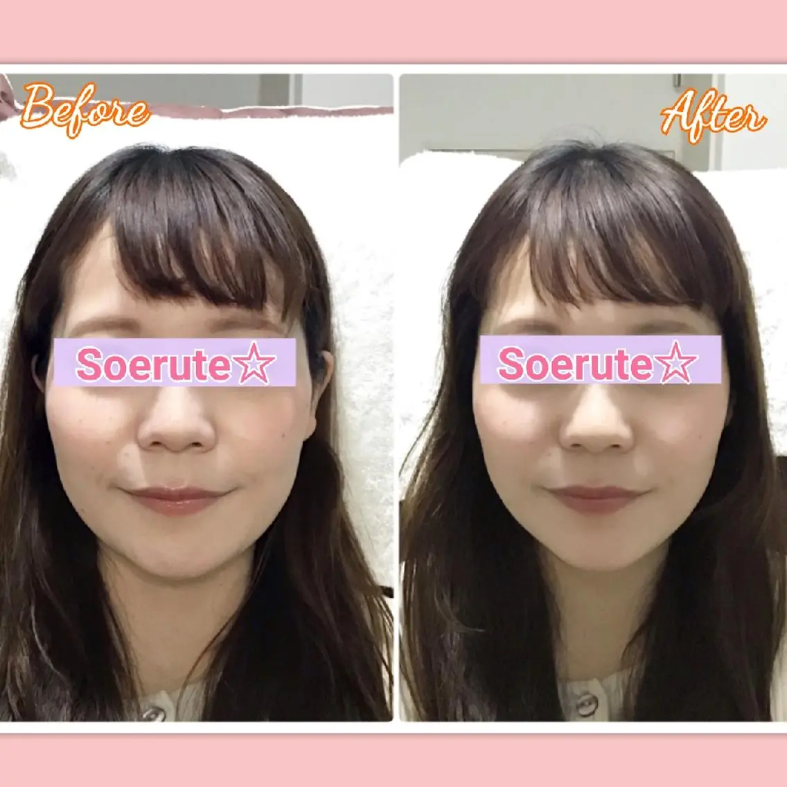 【📷小顔モニター募集中】周りから憧れられる小顔へ☆美容 小顔矯正　30分の写真