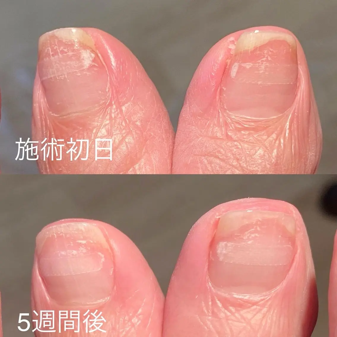 ネイル その他(ネイル) NAIL DOLCEのネイルデザイン
