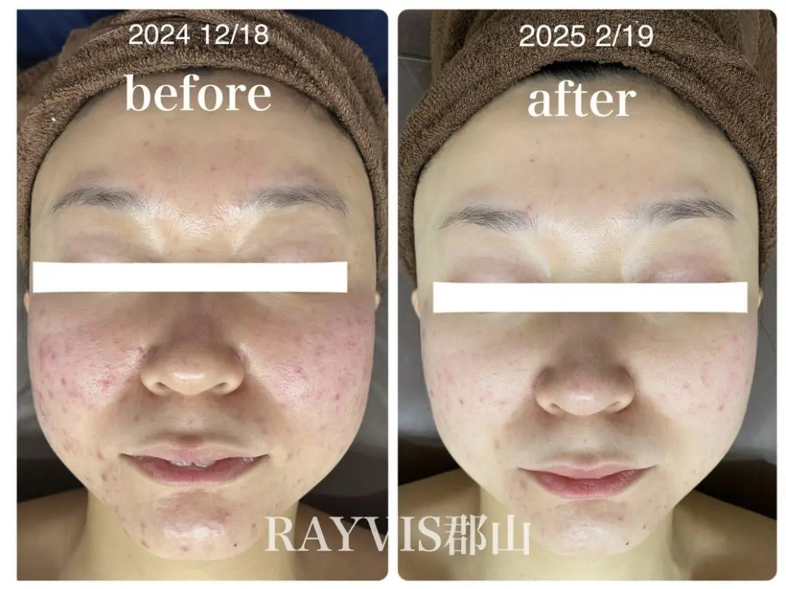 RAYVIS 郡山店　　小野のエステ・リラクイメージ