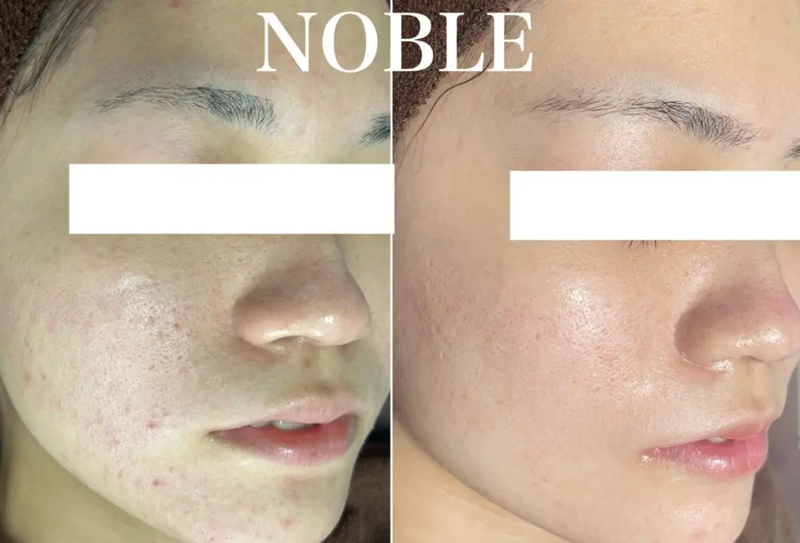 NOBLE 新宿南口店のエステ・リラクイメージ